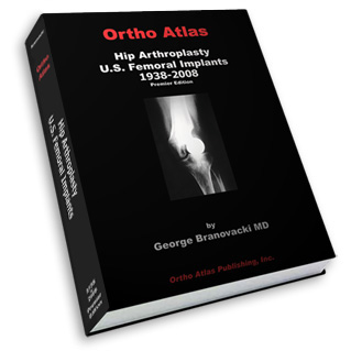 Hip Arthroplasty U.S. Femoral Implants 1938-2008 (Prod 8690)